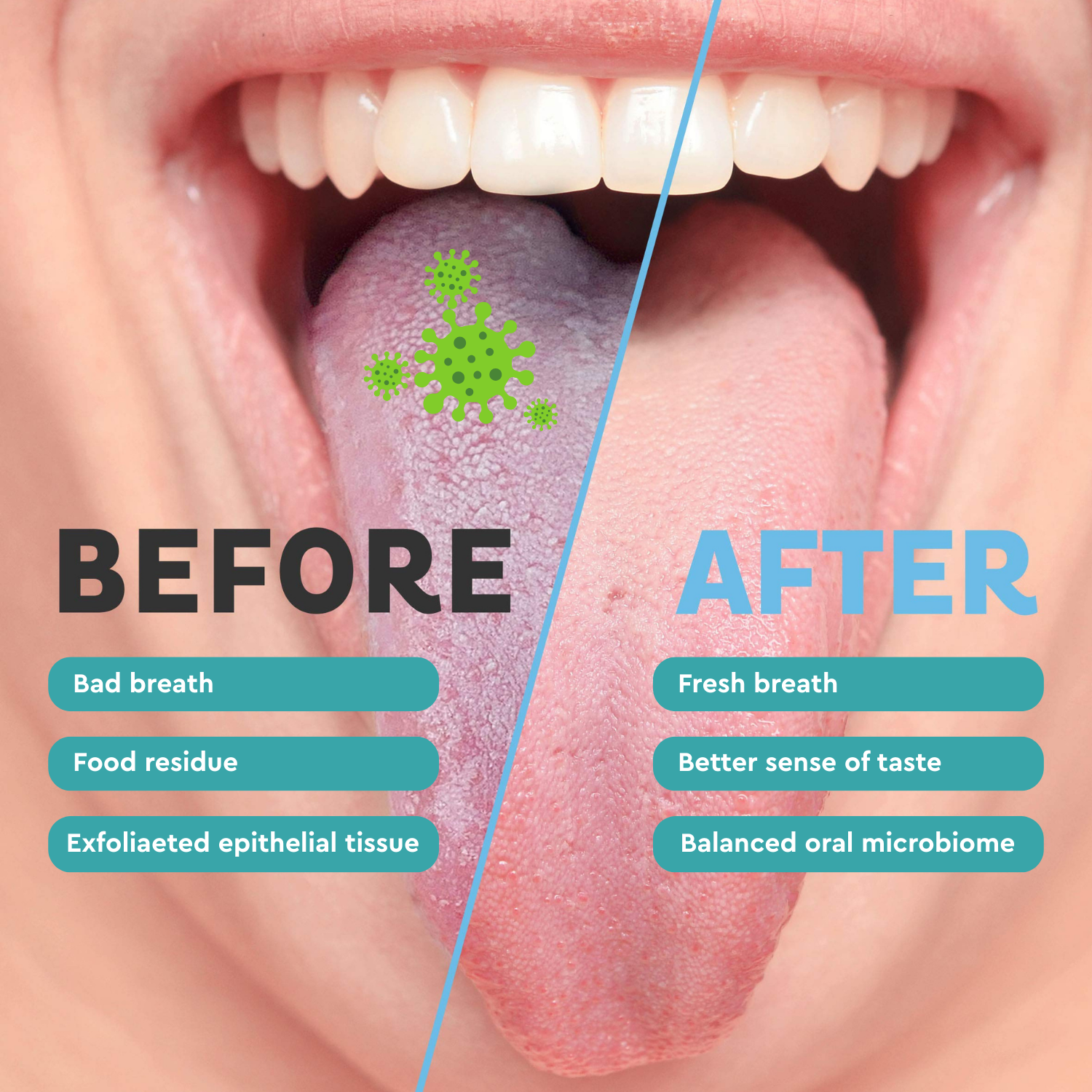 Zubio Stainless Steel Tongue Scrapper